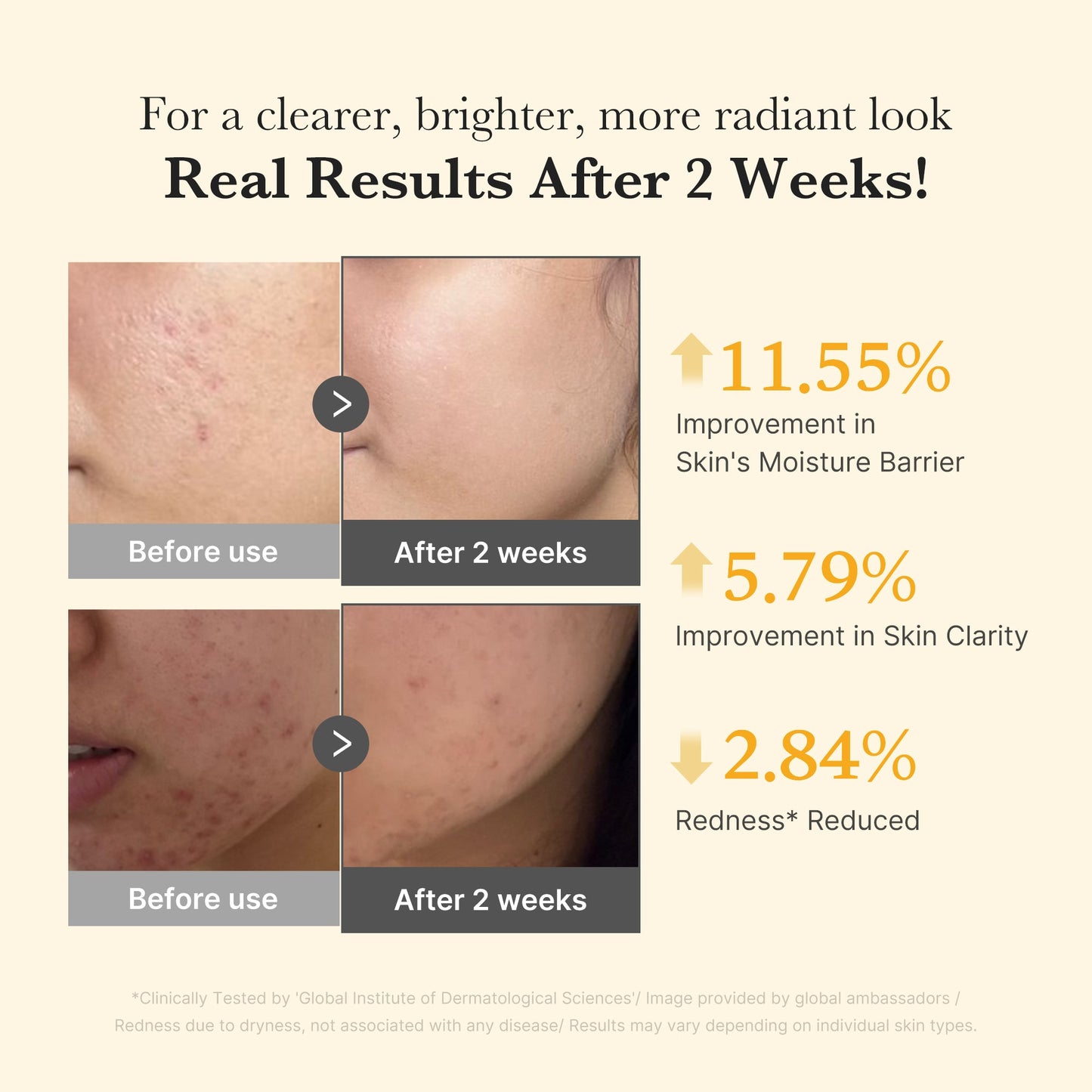 Kojic Turmeric Serum